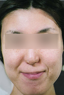 After
